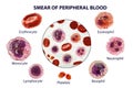 Smear of peripheral blood, 3D illustration