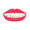 Smile with crooked teeth. White misaligned teeth with orthodontic bruxism