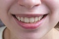 Smile and teeth of young woman by close up.Selective focus.Concept of dental care,good mood,positive