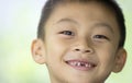 Smiling boy with missing teeth Royalty Free Stock Photo
