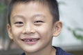 Smiling boy with missing teeth Royalty Free Stock Photo