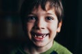 Smiling boy with missing teeth Royalty Free Stock Photo