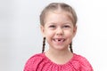 Smiling child without upper central teeth on white background