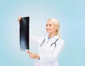 Smiling female doctor looking at x-ray image Royalty Free Stock Photo