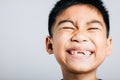 Boy smile shows missing upper tooth gap. Child dental growth isolated on white Royalty Free Stock Photo