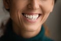 Smiling Latin woman show white healthy teeth Royalty Free Stock Photo