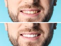 Smiling man before and after teeth whitening procedure on color background Royalty Free Stock Photo