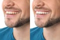 Smiling man before and after teeth whitening procedure Royalty Free Stock Photo