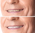 Smiling mature man before and after teeth whitening procedure Royalty Free Stock Photo