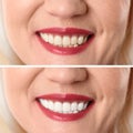 Smiling mature woman before and after teeth whitening procedure Royalty Free Stock Photo