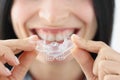 Smiling woman holding plastic mouth guard for teeth whitening