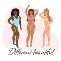 Smiling women in swimsuits of different nationalities and physiques with vitiligo. Different beautiful lettering Royalty Free Stock Photo