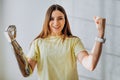 Woman with bionic prosthesis arm shows winner gesture Royalty Free Stock Photo