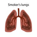 Smoker`s lungs. Damage to the lungs of a person caused by smoking.