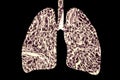 Smoker`s lungs, medical concept, 3D illustration, Lung disease conceptual image