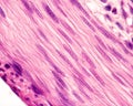 Smooth muscle cells. Nuclei