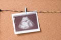 A snapshot of an ultrasound scan pinned to a rope on a cork board with a small wooden clothespin, pregnancy concept, find out the