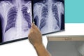 Soft and blurry image chest x-ray film of a patient with cardiac pacemaker, also with congestive heart and cardiomegaly.By surgery Royalty Free Stock Photo