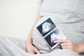 Soft focus and blurry of happy pregnant woman sitting on sofa at