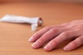 Crop hand with chilblain of woman placed on wooden table near tube with medical unguent for treatment Royalty Free Stock Photo