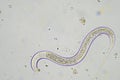 soil switcher nematode, microorganism and soil biology, with nematodes and fungi under the microscope. in a soil and compost Royalty Free Stock Photo