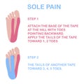 Sole pain. Correct kinesiology taping.