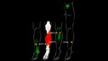 Soleus muscle. Trigger points and reflected leg pain. Myofascial release.