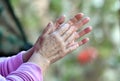 Some hands applauding the health services