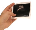 Sonogram Royalty Free Stock Photo