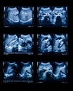 Sonography upper abdomen medical examination