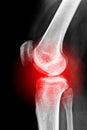 Sore knee Royalty Free Stock Photo