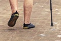 sore legs of an elderly man walking along the beach paths. Royalty Free Stock Photo