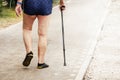 sore legs of an elderly man walking along the beach paths. Royalty Free Stock Photo