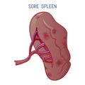 Sore spleen icon, cartoon style