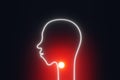 Sore throat concept Human head silhouette with red glowing acute nasopharynx virus pain 3d rendering Tonsillitis illness