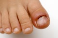 Inflammation of a fingernail bed Royalty Free Stock Photo