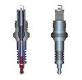 Spark plug