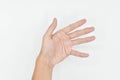 Spastic hand. Hand muscle spasticity Royalty Free Stock Photo