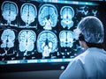 A special computer proam scanning a patients brain scans with the help of AI and deep learning to detect any