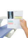 Special exam Hand doctor look results spine bone density.too blurriness and artifacting image