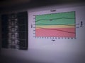 BMD spine bone mass image The graph has a standard point hight Therefore diagnosed no osteoporosis.