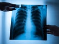 Specialist doctor examining x-ray film Royalty Free Stock Photo