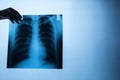 Specialist doctor examining x-ray film Royalty Free Stock Photo