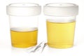 Specimen cups for urinalysis Royalty Free Stock Photo