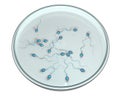 Spermatozoans in Petri dish, concept for artificial fertilization