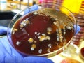 Sphingomonas, E. coli, Propionibacteria and Streptococcus on Chocolate Agar Royalty Free Stock Photo
