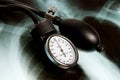 Sphygmomanometer on Xray photo