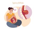 Spina Bifida concept. Royalty Free Stock Photo