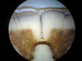Spinal cord cross section