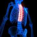 Spinal cord Thoracic Vertebrae a Part of Human Skeleton Anatomy